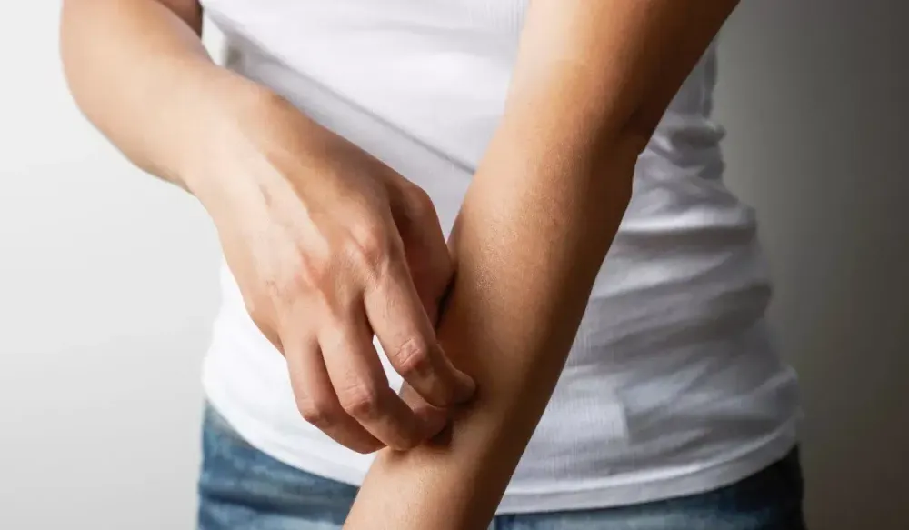 Person scratching irritated skin on their arm